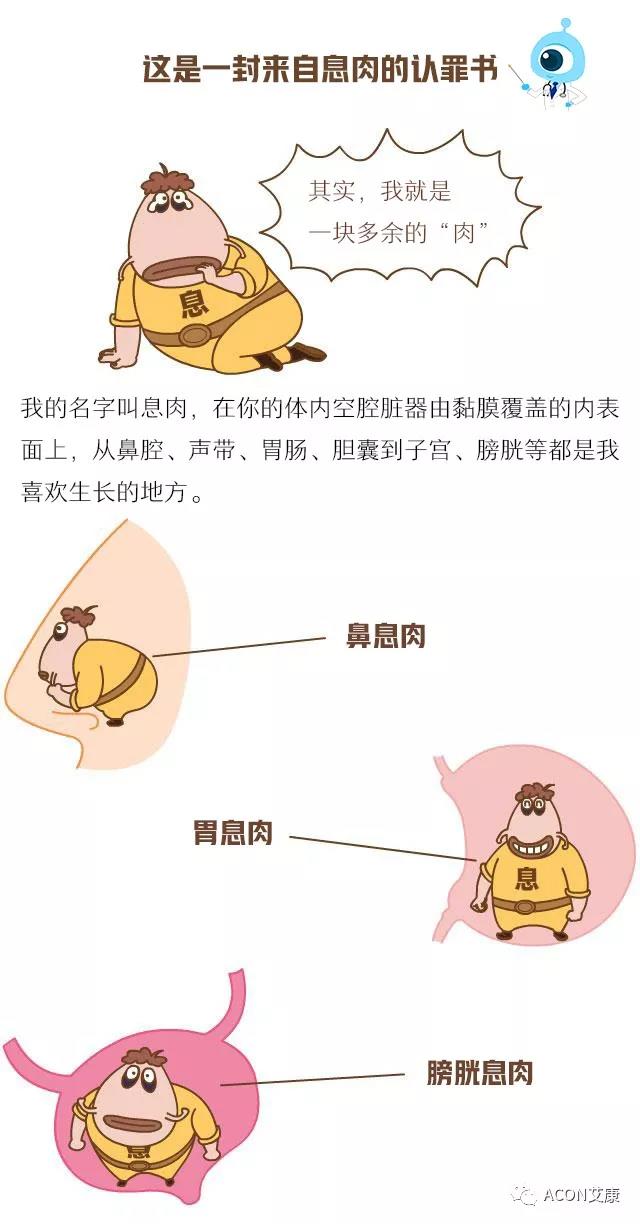 “艾”漫畫 | 這是一封來自息肉的《認(rèn)罪書》