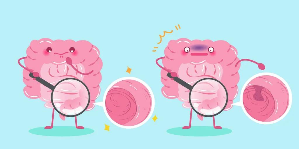 因為忽視身體出現(xiàn)的這些變化，他們最后被確診結(jié)腸癌