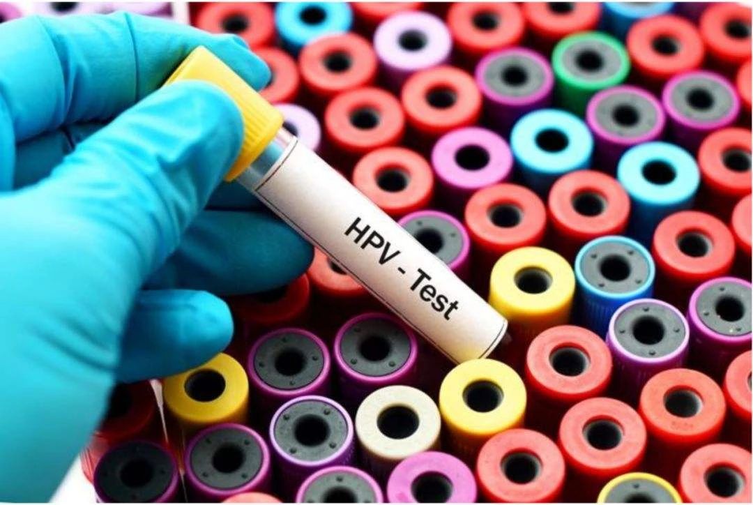 HPV分型檢測(cè)的重要性
